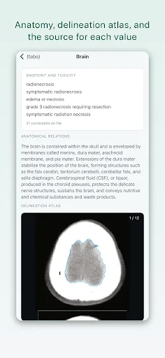 Isodose RT Android app screenshot 2